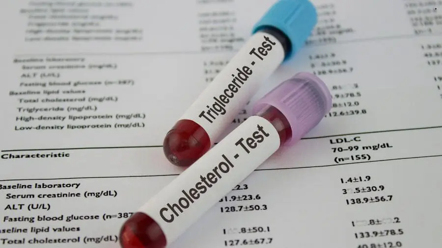 O colesterol n&atilde;o &eacute; inimigo do corpo. O verdadeiro risco est&aacute; no excesso e no desequil&iacute;brio entre suas fra&ccedil;&otilde;es