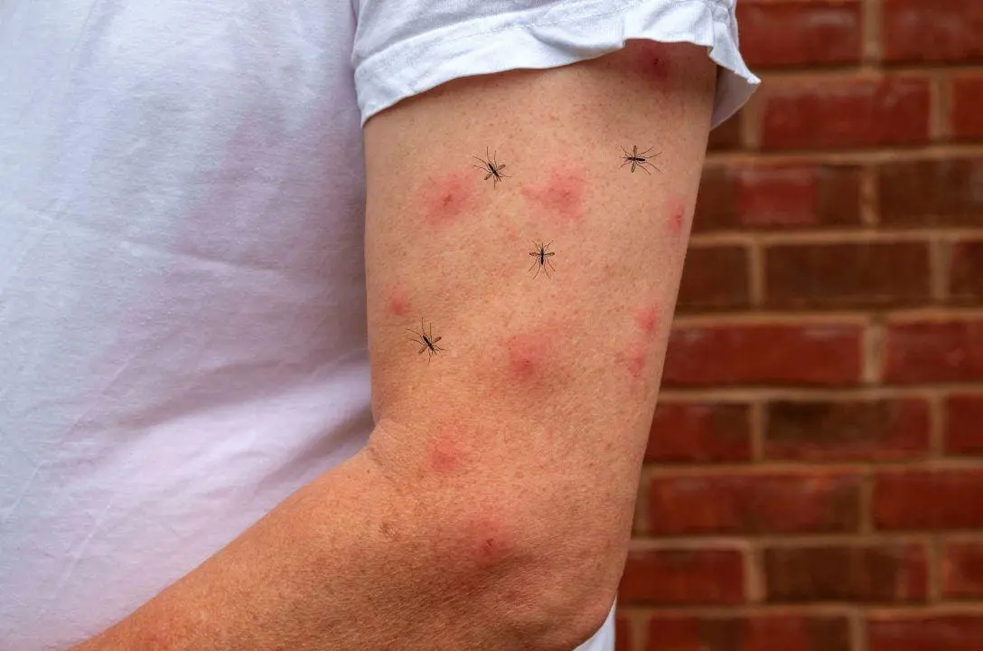 Descubra agora alguns fatores que te tornam um verdadeiro Ímã de mosquitos
