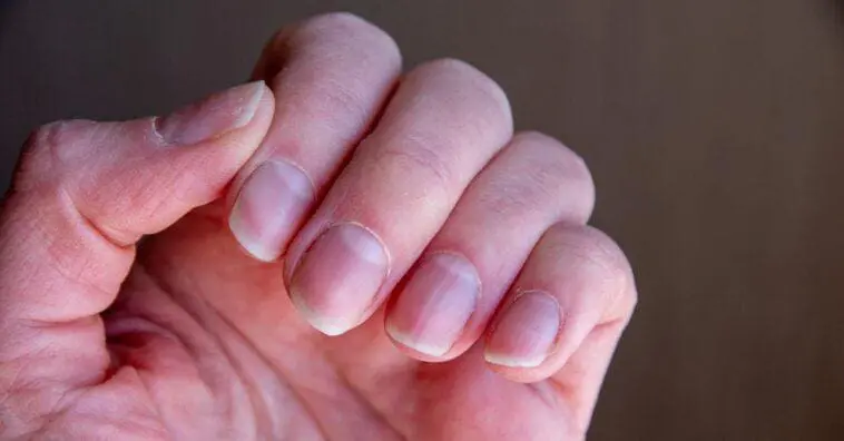 Descubra o Significado das Linhas nas Unhas e Como Cuidar Delas