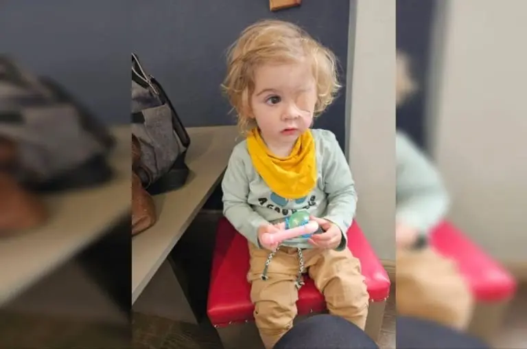 Menino de 2 anos perdeu a visão de um olho após ser beijado