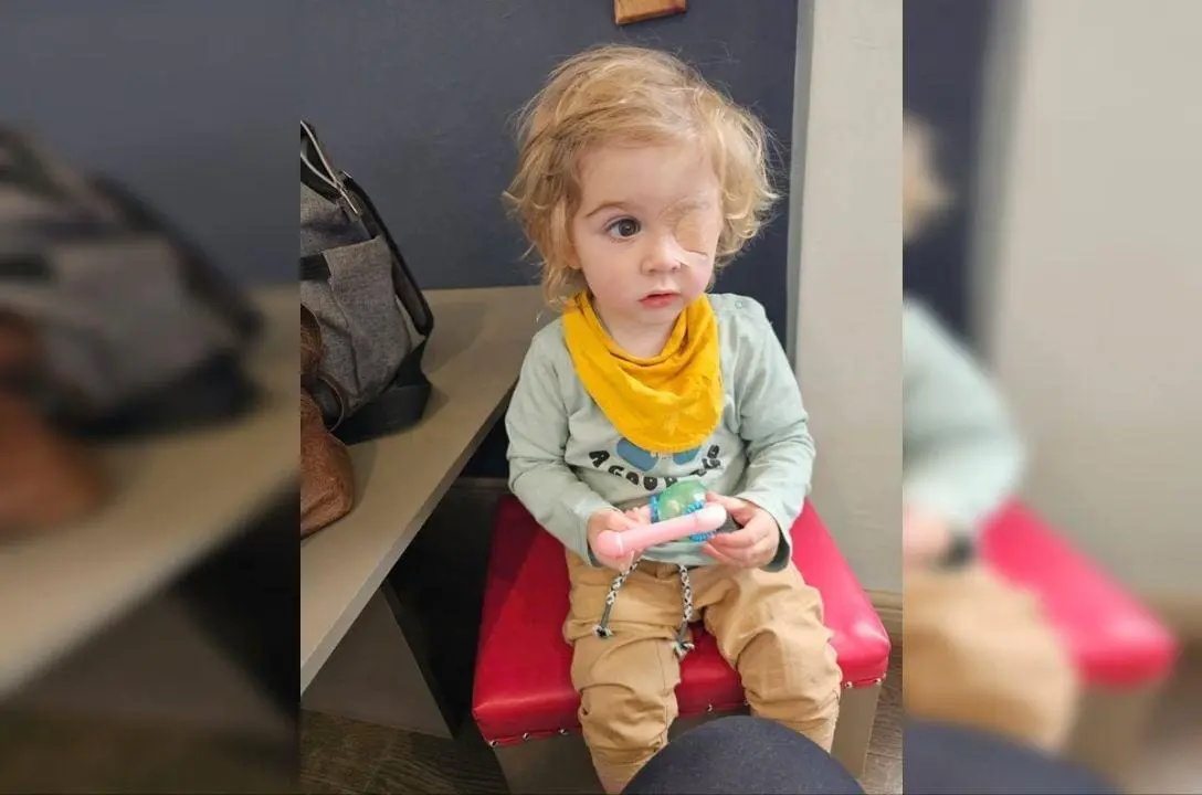 Menino de 2 anos perdeu a visão de um olho após ser beijado