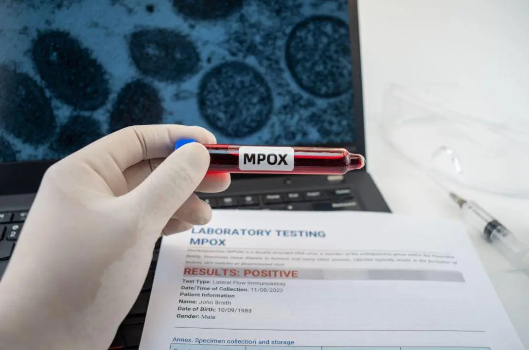Saiba tudo sobre a Mpox, a doença que voltou a preocupar o mundo