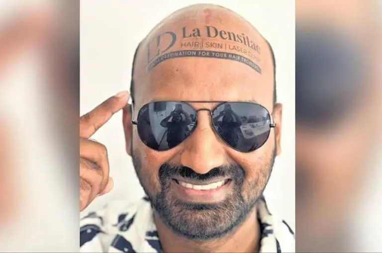 Uma cabeça brilhante! Homem fatura bem com sua calvície