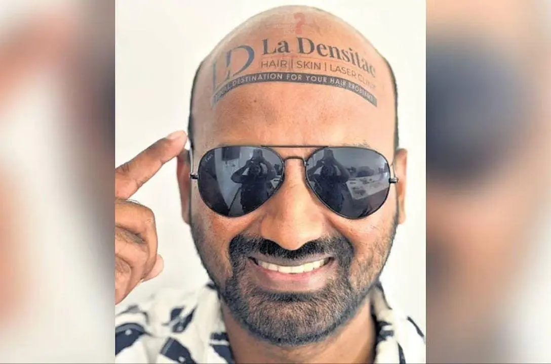 Uma cabeça brilhante! Homem fatura bem com sua calvície