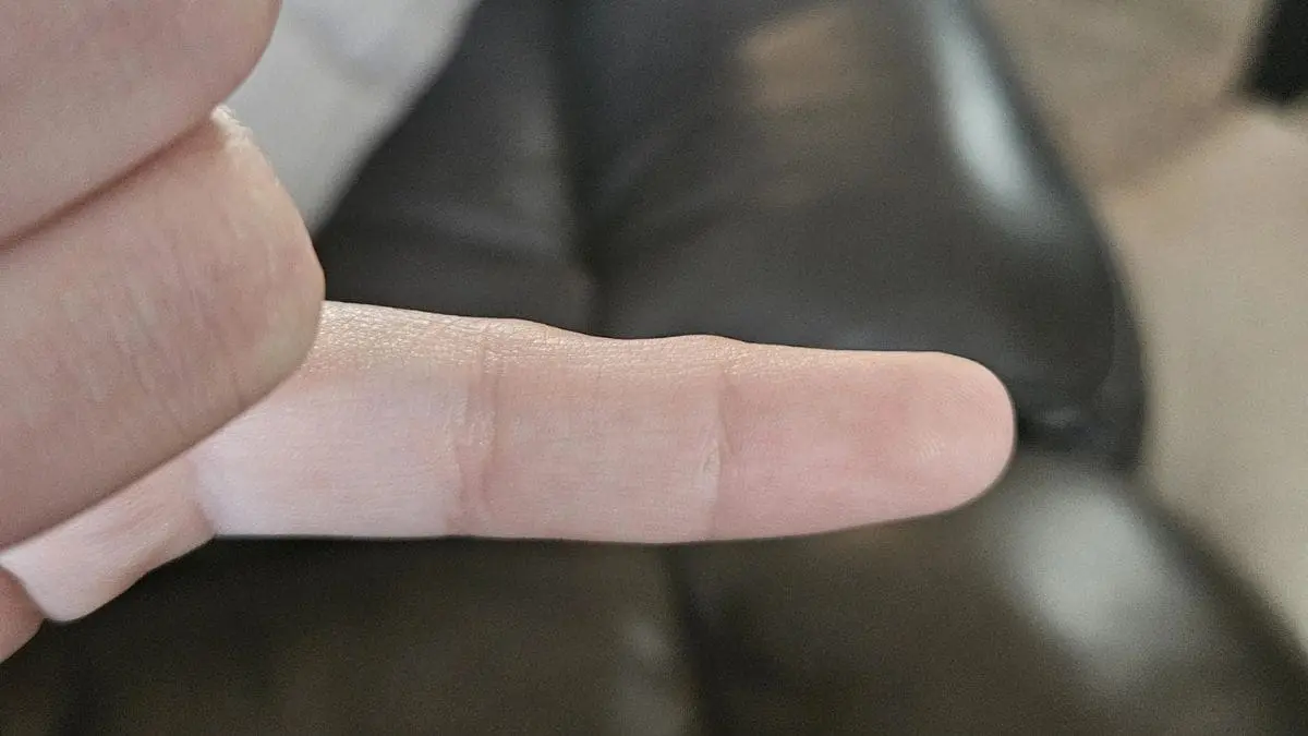 Pequenas mudan&ccedil;as no corpo podem ser sinais de h&aacute;bitos repetitivos que, com o tempo, evoluem para problemas maiores.