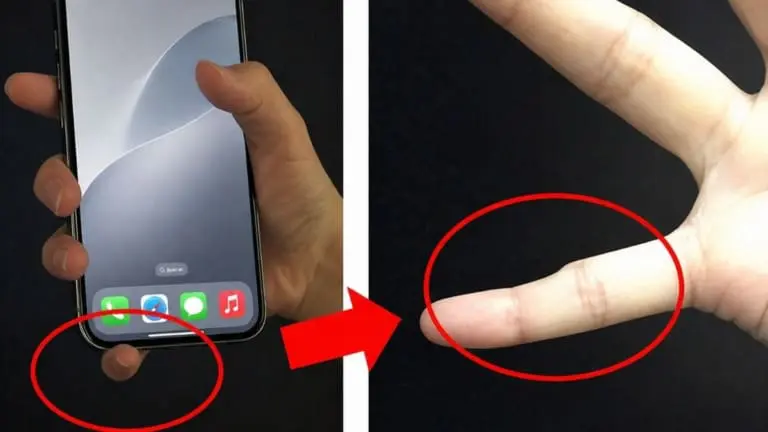 Mindinho de smartphone: você também tem dedo torto por usar celular?