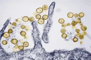 Pandemia Hantavirose
