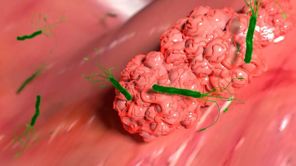 A Helicobacter pylori &eacute; uma bact&eacute;ria resistente e adaptada ao ambiente &aacute;cido do est&ocirc;mago. Ela pode se instalar na mucosa g&aacute;strica e permanecer ali por longos per&iacute;odos.