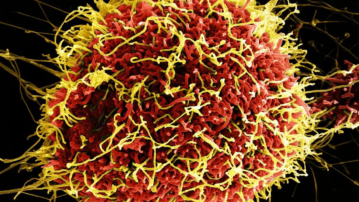O alerta foi emitido ap&oacute;s a confirma&ccedil;&atilde;o de casos na Rep&uacute;blica Democr&aacute;tica do Congo e em Uganda, envolvendo a cepa Bundibugyo do v&iacute;rus ebola