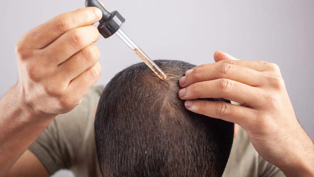 Uso minoxidil. Meus gatos e cachorros correm perigo? O que fazer? Se há suspeita de contato com minoxidil, a pergunta não deve ser “será que foi muito?”. A atitude mais segura é procurar ajuda veterinária na hora