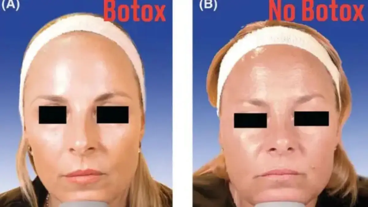 O caso não mostra que uma das irmãs parou de envelhecer. Ele sugere que décadas movimentando determinados músculos de formas diferentes podem deixar marcas diferentes no rosto.