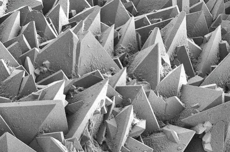 Assim são as pedras nos rins vistas em um microscópio