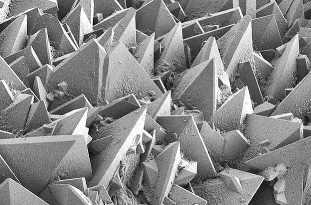 Assim são as pedras nos rins vistas em um microscópio