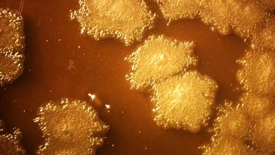 Cientistas testam bactéria que pode se alimentar do câncer À medida que a bactéria avança para as bordas do tumor, ela encontra regiões com mais oxigênio