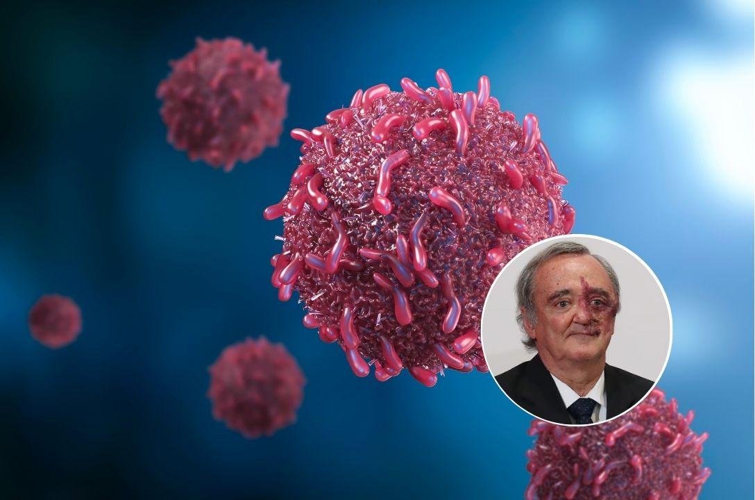 Cientista eliminou completamente câncer de pâncreas em testes