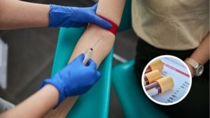 HDL e LDL: o que seu exame de colesterol revela de verdade?