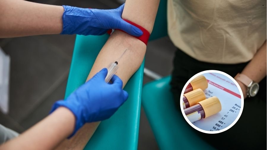 HDL e LDL: o que seu exame de colesterol revela de verdade?