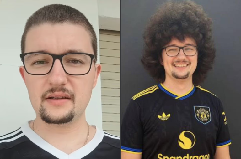 Entenda a promessa do torcedor cabeludo do Manchester United