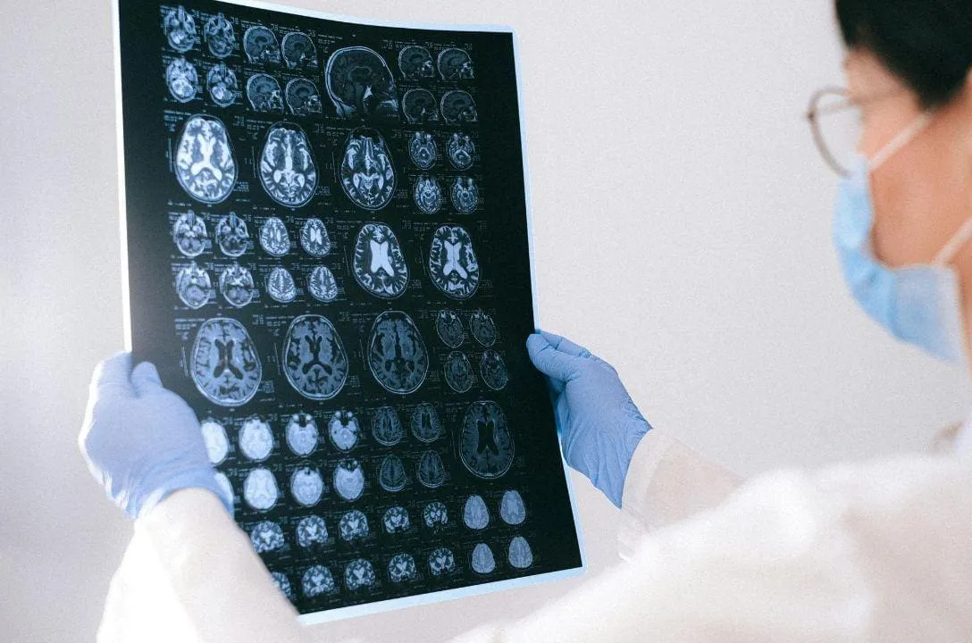 estudo revela diferencas do cerebro feminino e masculino c3249