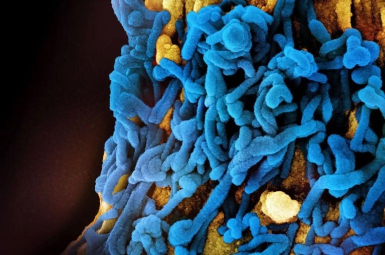 Etiópia confirma casos de vírus Marburg e preocupa OMS