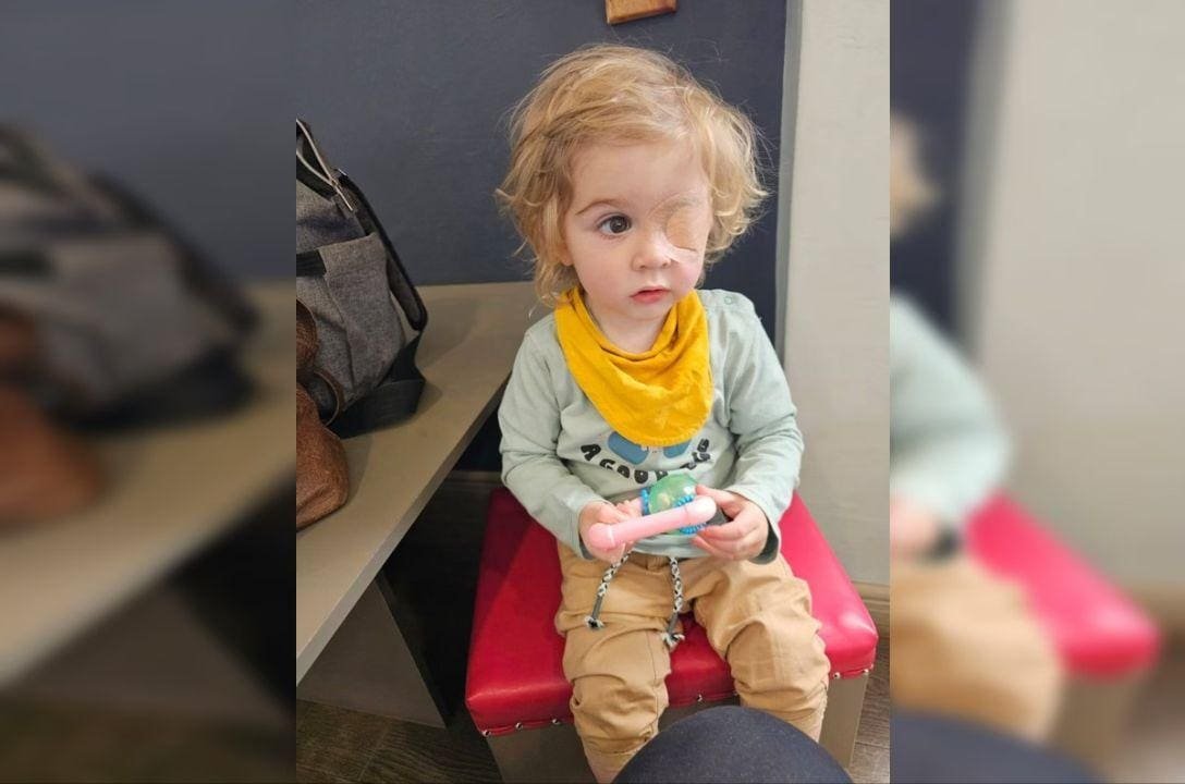 Menino de 2 anos perdeu a visão de um olho após ser beijado