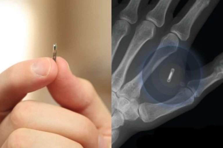 Milhares de pessoas trocaram as chaves de casa por um chip na mão