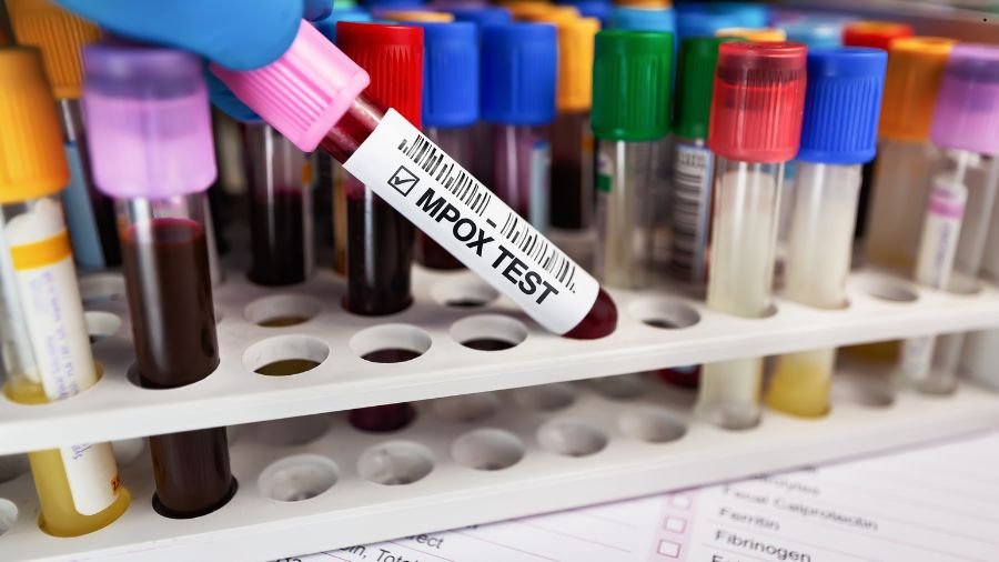 O crescimento de casos n&atilde;o significa uma epidemia, mas refor&ccedil;a a necessidade de monitoramento constante