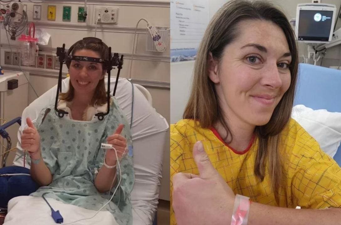 Mulher tem cabeça reimplantada após "decaptação interna"