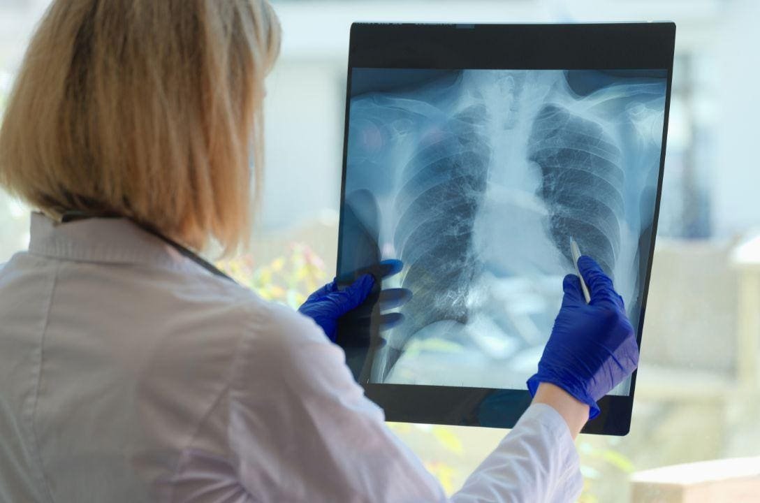 Não fumar não te deixa livre de ter doenças respiratórias. Conheça outros fatores de risco.