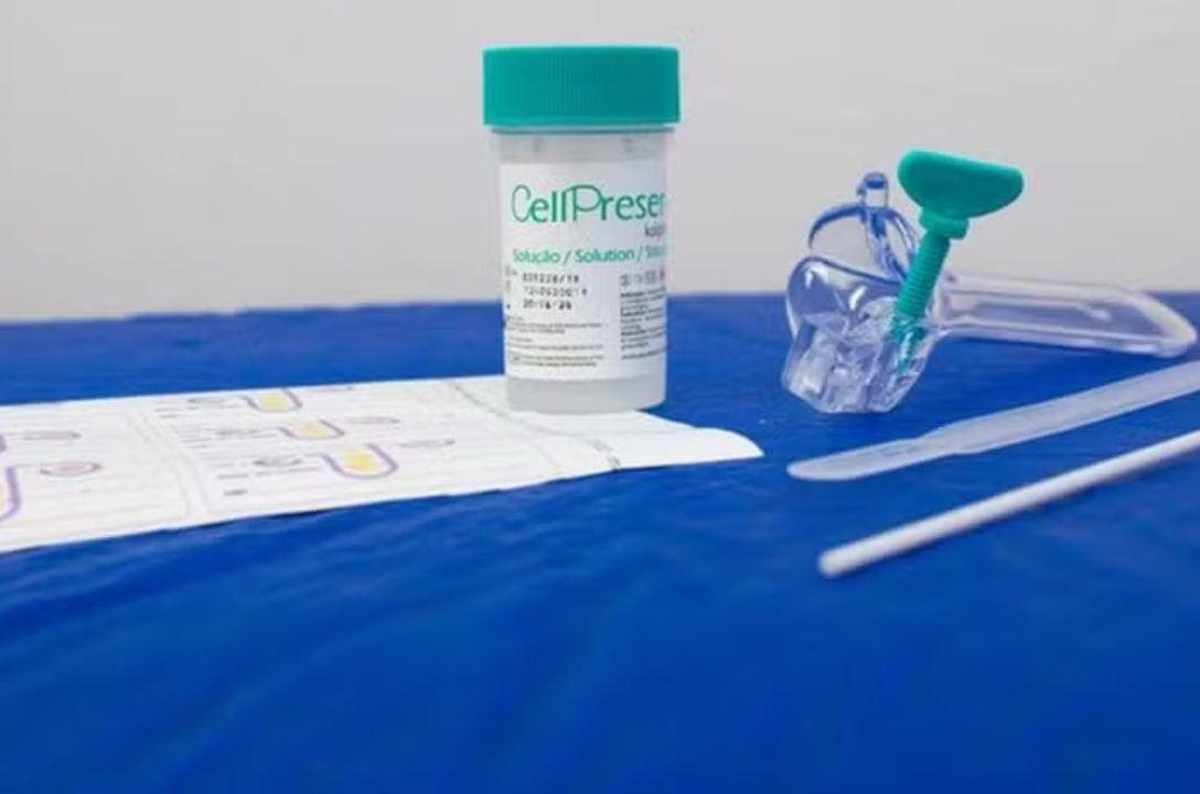 Novo teste do SUS pode detectar câncer de colo do útero