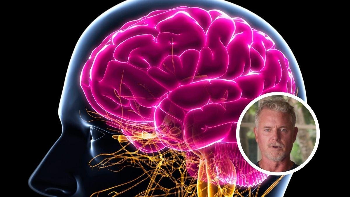 O que é ELA? Entenda a doença que levou Eric Dane aos 53 anos