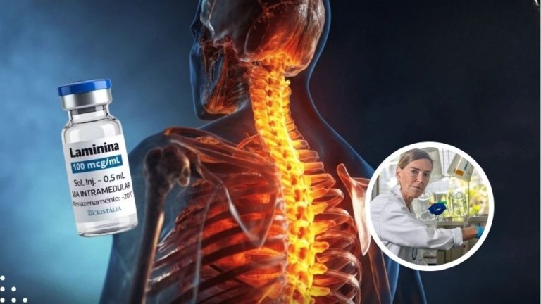 A polilaminina é considerada uma candidata promissora