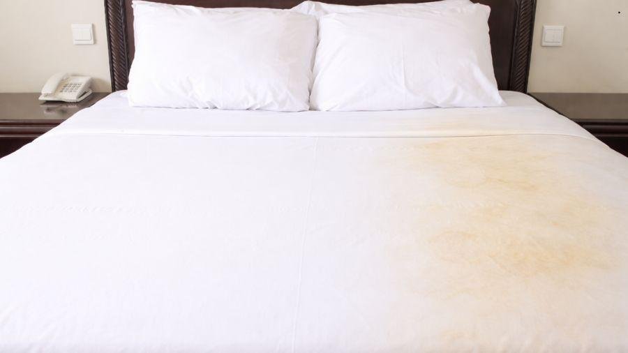 Por que o lençol do lado do homem fica amarelo? Entenda