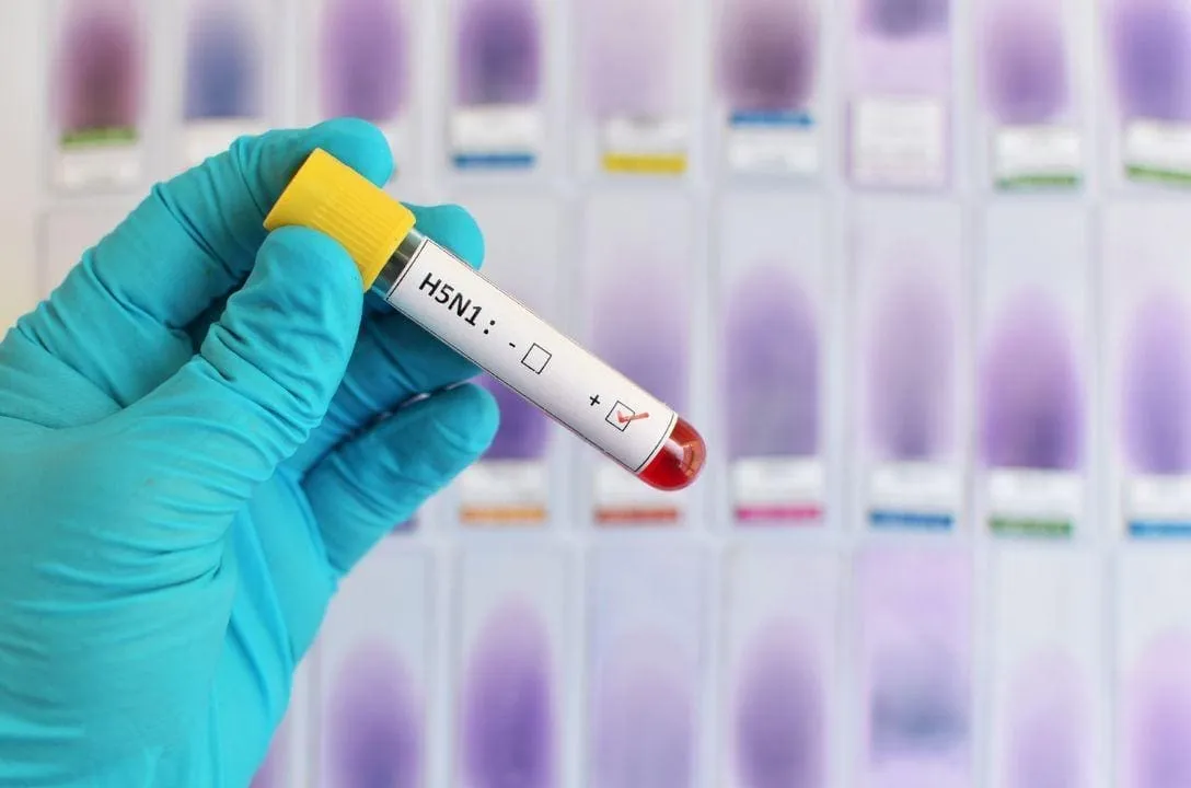 primeira infeccao humana por gripe aviaria quais os riscos e768a