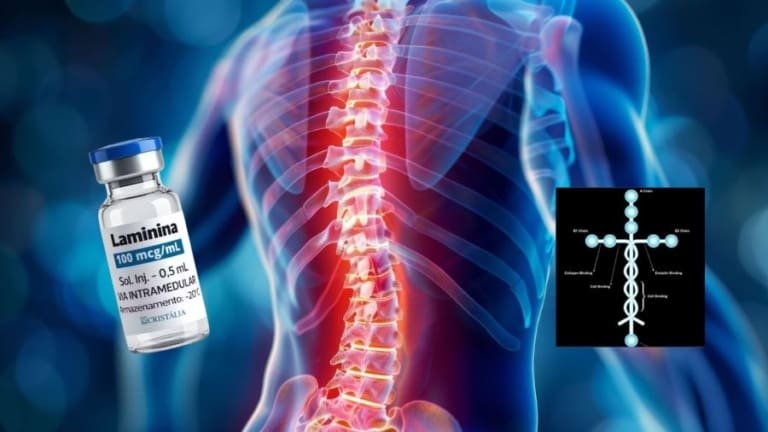 Saiba como está o andamento das pesquisas com polilaminina