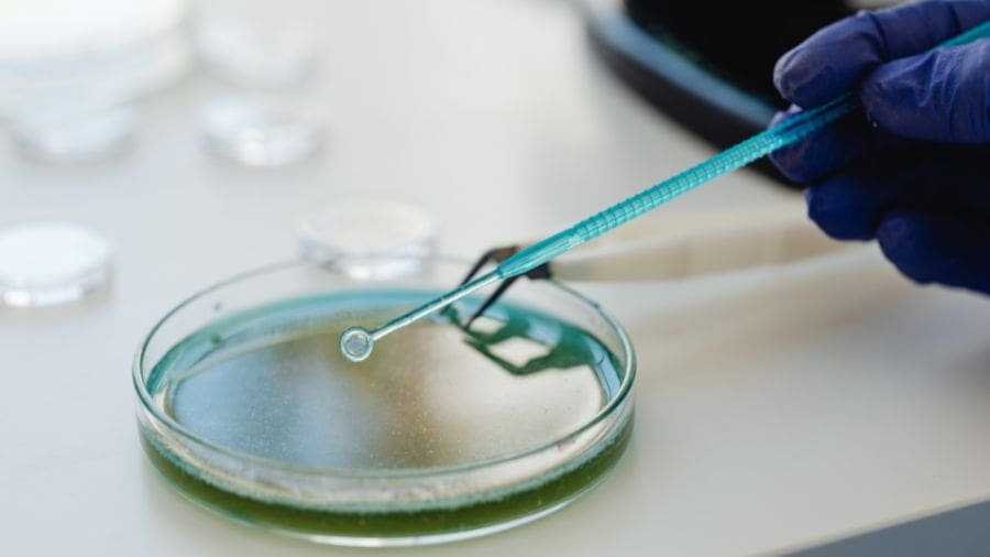 A broncopneumonia bacteriana &eacute; uma infec&ccedil;&atilde;o pulmonar causada por bact&eacute;rias