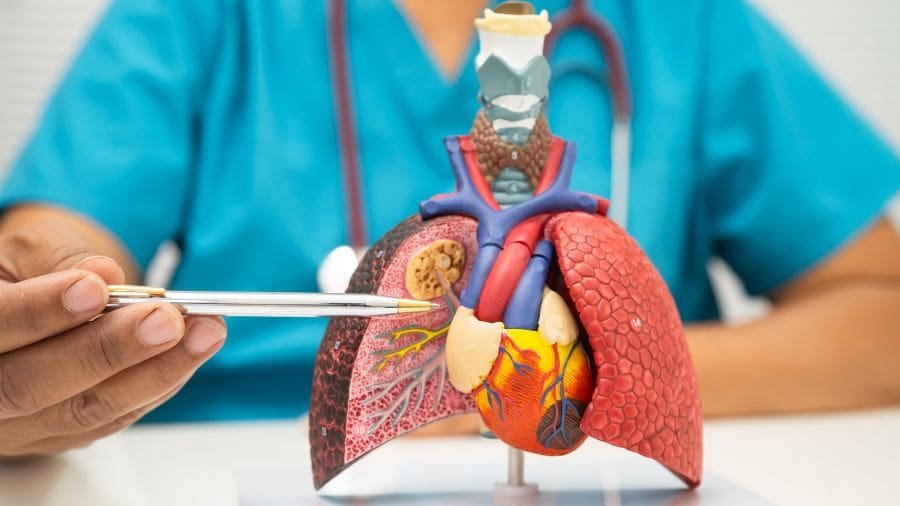 Na maioria das vezes, a broncopneumonia bacteriana aparece ap&oacute;s epis&oacute;dios de gripe