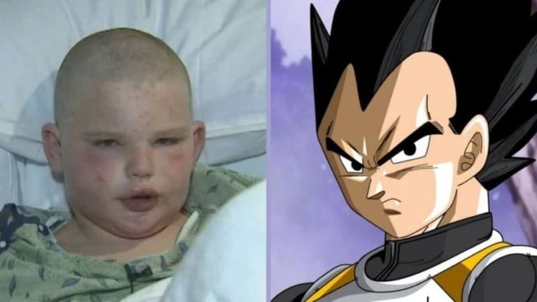 Garoto lembra de Vegeta e sobrevive a ataque de 400 abelhas