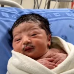 Bebê de bigode é real? Entenda o que sabemos sobre a notícia viral