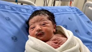 Bebê de bigode é real? Entenda o que sabemos sobre a notícia viral