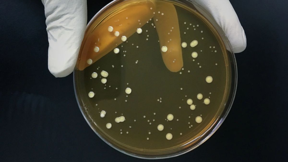 Diarreia transmitida pelo sexo mostra resistência a antibióticos Os sinais mais comuns incluem diarreia, febre, dor abdominal e sensação de precisar evacuar mesmo quando o intestino está vazio
