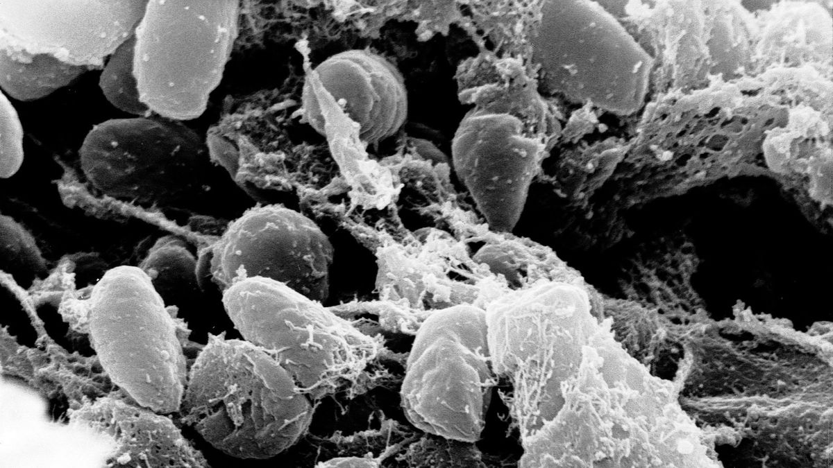 At&eacute; a apura&ccedil;&atilde;o realizada para este texto, em 5 de outubro de 2026, a suspeita de peste pneum&ocirc;nica n&atilde;o havia sido confirmada publicamente pelas autoridades sanit&aacute;rias russas